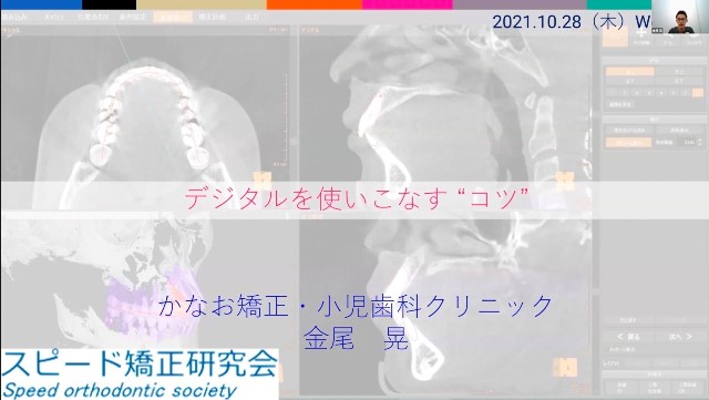 zoomによる講演会 zoomによる講演会